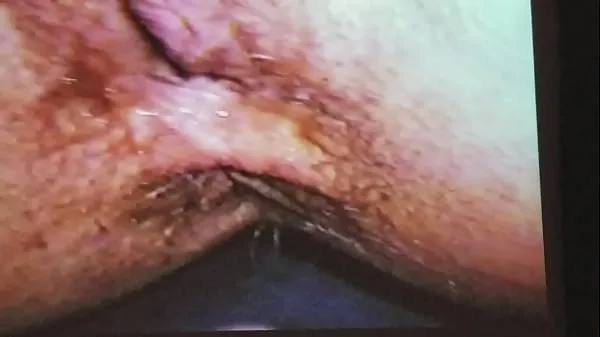 Watch Close up anal energy Tube