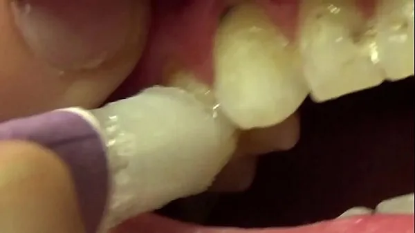 Watch Applying Whitening Paste To Her Filthy Teeth energy Tube