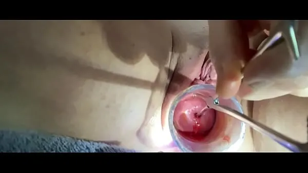 Sound tenaculum controlling uterus Enerji Tüpünü izleyin